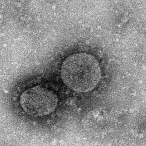 �¹ڲ�������25���������������Lɶ����